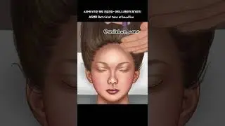 ASMR 머릿니 시원하게 제거하기 | 지루성 두피 치료ㅣGet rid of tons of head lice #shorts #treatment #animation #beauty