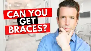 You eligible for Invisalign?
