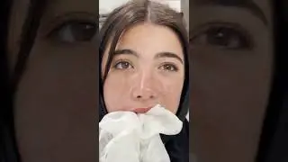 Orthodontist Reacts: Wisdom Teeth Removal And How To Avoid Dry Sockets 😩 