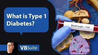 Visible Body | What is Type 1 Diabetes?