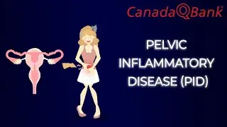 Pelvic Inflammatory Disease (PID)