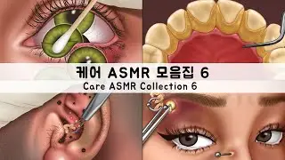 ASMR 케어 애니메이션 모음집6 | 블랙헤드, 귀피지, 다래끼, 왁싱 | CARE ANIMATION COLLECTION6 | Blackhead,Sebum,Stye,Waxing