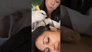 asmr scalp 
