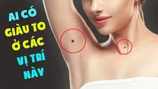 10 Nốt Ruồi Quý Hơn Vàng Của Phụ Nữ, Quyết Định Cuộc Đời Giàu Sang Phú Quý - Phần 2