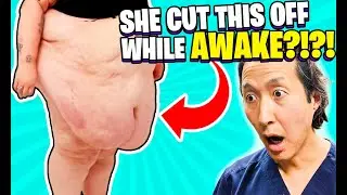 She Cut Off 20 Lb of Tummy While AWAKE!
