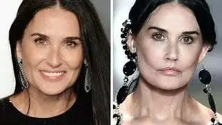 Celebrities who disfigured their faces for plastic surgery