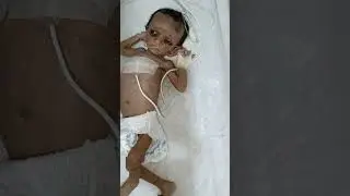 very hard and dengerous look baby admitted in nicu 