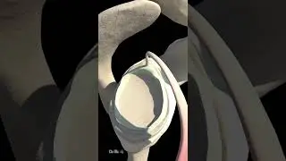 What Is a Shoulder SLAP Tear (Animation)