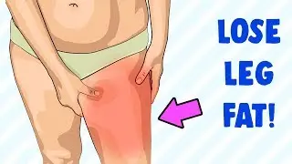 How To Lose: Legs Fat Fast (Do This Everyday)