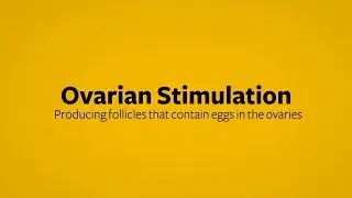 In Vitro Fertilization Ovarian Stimulation