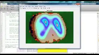 Image Processing Final Year Projects | Image Processing Final Year Thesis