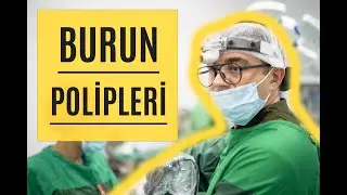 ANTRO XOANAL POLİPİN ENDOSKOPİK ÜSULLA ÇIXARILMASI. BURUN POLİPİ. Xaliq Şıxəliyev Lor-plastik-cərrah