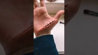 The serious wound on my hand looks like a hoax cinematographic 