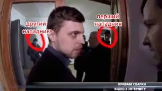 Суперечка із міською владою Конотопа закінчилася кров’ю