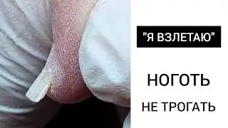 ВЗЛЕТНЫЙ ноготь  // Любимый Василек