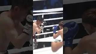 Крутая техника Энтони 