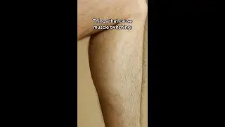 Annoying Muscle Twitch? When to Seek Help