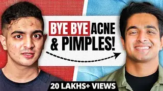 Top 3 Apple Cider Vinegar Benefits | Remove Pimples, Acne & Dandruff | Ranveer Allahbadia