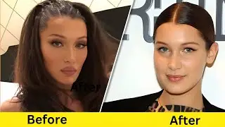 Plastic Surgery Dramatically Changed These Celebrities