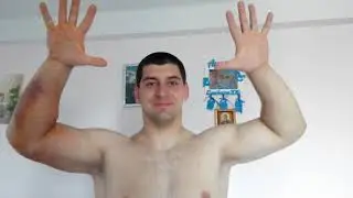 My biceps tear with Oleg Zhokh