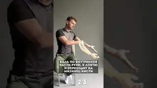 Упражнения от боли в руке (нервы)